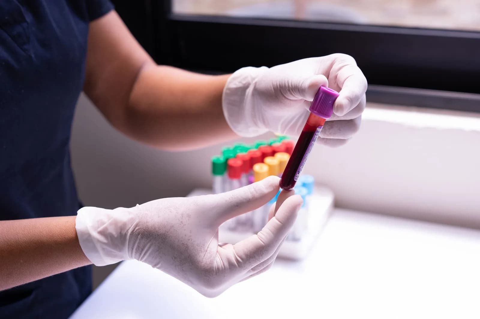 Thiếu máu do thiếu sắt và mang gen Thalassemia khác nhau thế nào